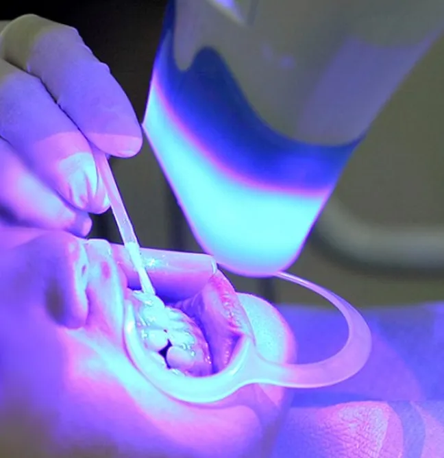 Activation du gel par la lumière