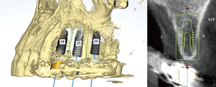 Examen radiologique 3D et planification numérique