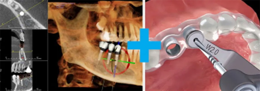 Examen radiologique 3D de la mâchoire