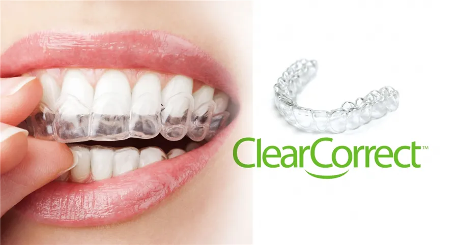 Système ClearCorrect par Straumann