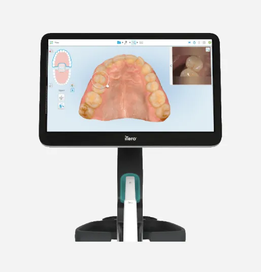 Scanner intra-oral iTero